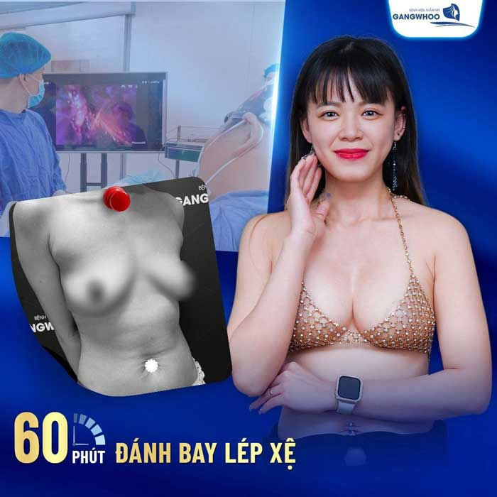 Địa chỉ treo sa trễ ngực hạn chế để lại sẹo