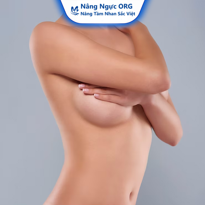 Bác sĩ giải đáp: Có nên thả rông sau nâng ngực?