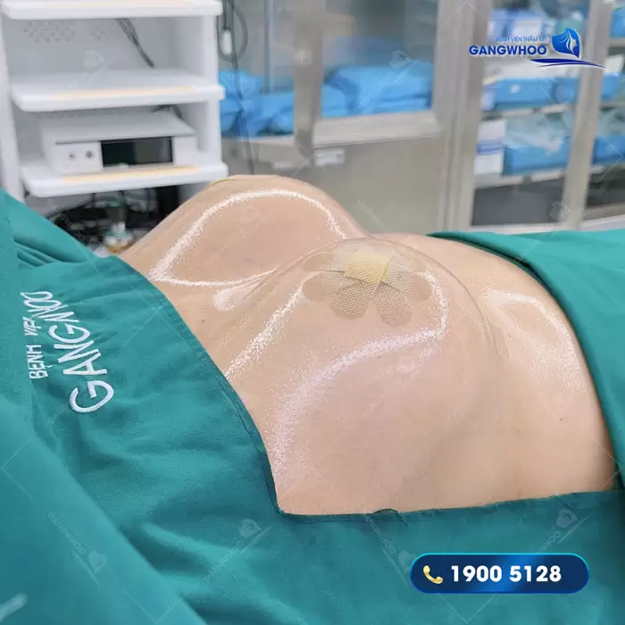 6 Địa Chỉ Nâng Ngực Ở Quận 3 Được Nhiều Người Review